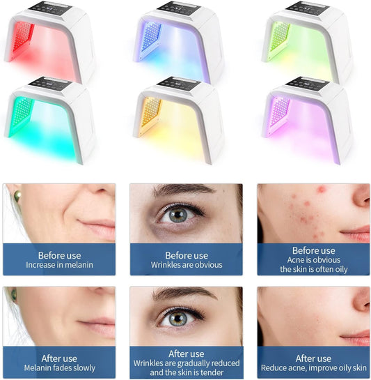 Red Light Therapy Lamp with Nano Spray,6 Colors Led Light Therapy Mask,Pdt Machine,Led Face Light Therapy Mask,178Pcs Leds,Anti-Anging,Rejuvenation,Firming,Smooth Wrinkle,Skin Brighten